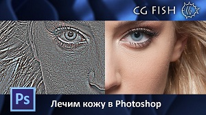 Лечим кожу в Photoshop